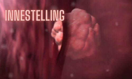 cursus thumbnail